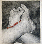 La déchirure